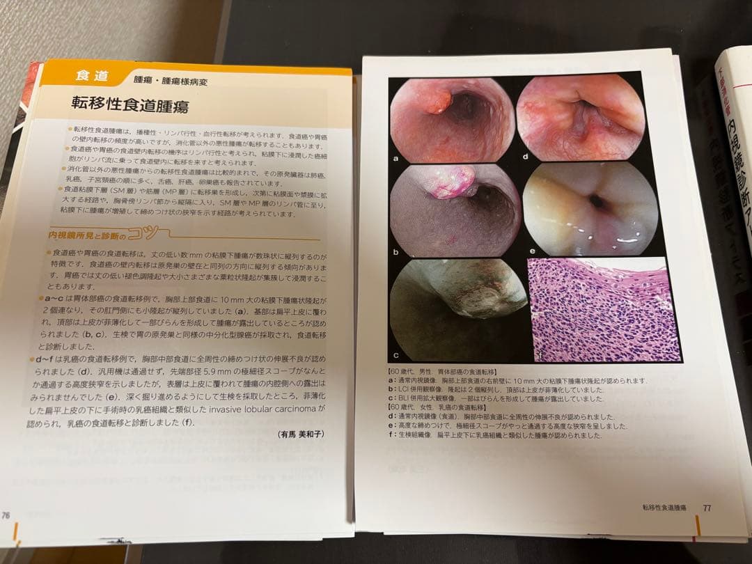 内視鏡診断アトラス 上下セット【裁断済み】
