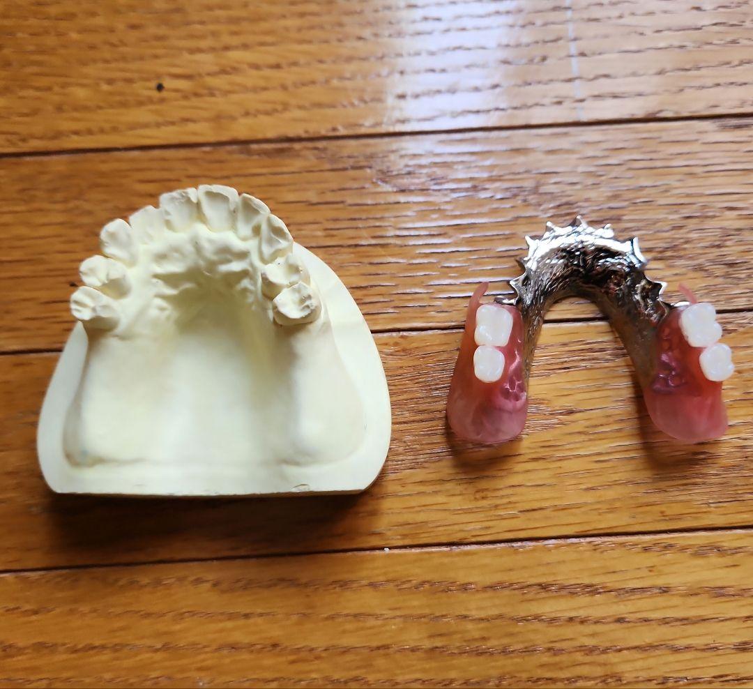 ○歯科用　部分床義歯ノンメタルクラスプ義歯デモ用模型
